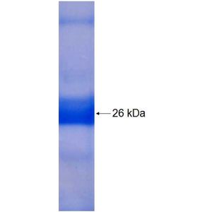 Recombinant Human ALG14 protein, His-tagged