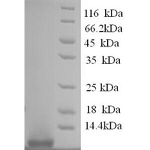 Anti-6X His tag® antibody(AB9108)