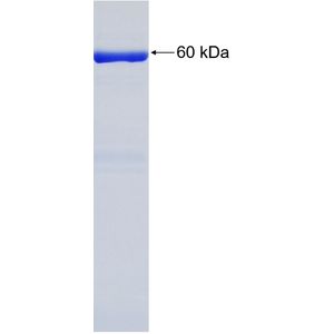 Recombinant Human ALKBH4 protein, GST-tagged