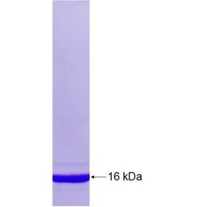 Recombinant Human ABL1 protein, His-tagged