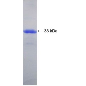 Recombinant Human ABHD10 protein, His-tagged