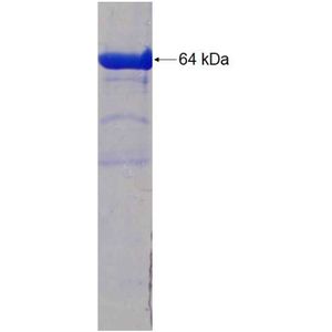 Recombinant Human AKR7A3 protein, GST-tagged