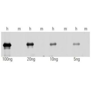 p21 Waf1/Cip1 (187) HRP