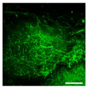 Anti-alpha smooth muscle Actin antibody