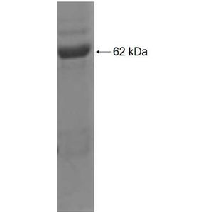 Recombinant Human AASDHPPT protein, GST-tagged