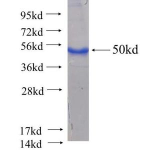 Recombinant Human ACADL protein, His-tagged