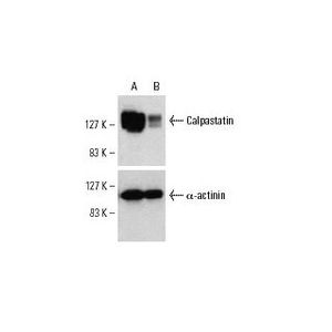Calpastatin siRNA (h)