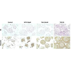 Anti-Vimentin antibody [EPR3776] - Cytoskeleton Marker