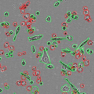 Incucyte® AI Cell Health Analysis Software Module
