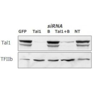 SilenceMag -siRNA Transfection Reagent