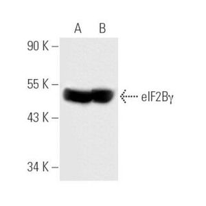 eIF2Bγ (P-5)