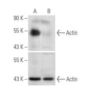 Amylase shRNA Plasmid (h)