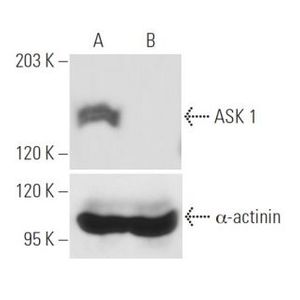 ASK 1 siRNA (h)