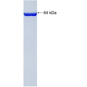 Recombinant Human AAMP protein, GST-tagged