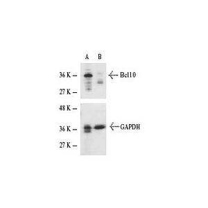 Bcl10 siRNA (m)