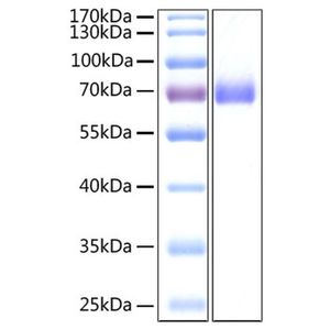 2019-nCoV Spike S2 ECD Protein