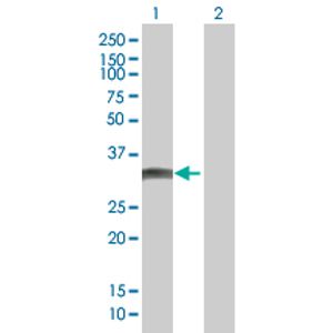 Mouse IgG ELISA Kit(AB151276)
