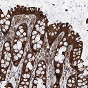 Human VEGF ELISA Kit(AB222510)
