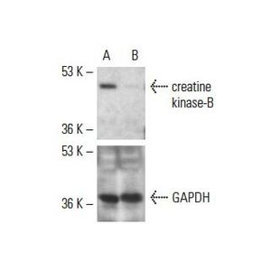 creatine kinase-B siRNA (h)