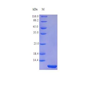 Anti-CDKN2A/p16INK4a antibody [EPR1473] - C-terminal(AB108349)
