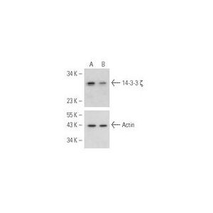 14-3-3 ζ siRNA (h)