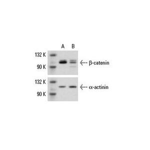 β-catenin siRNA (m)