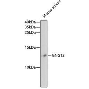 Anti-GNGT2 antibody