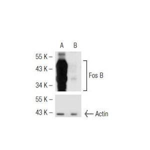Fos B shRNA Plasmid (h)