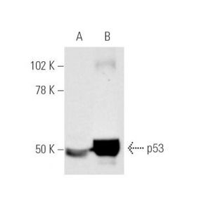 p53 (Pab 240)