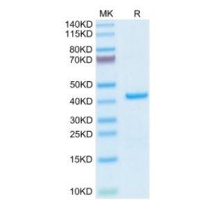 Recombinant Human AIMP1 protein, His-tagged