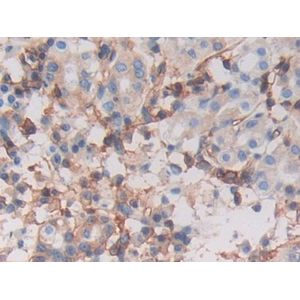 GFP ELISA Kit, Fluorescent(AB229403)