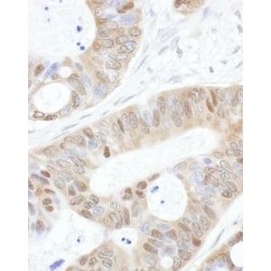 Acetate Assay Kit (Colorimetric)(AB204719)