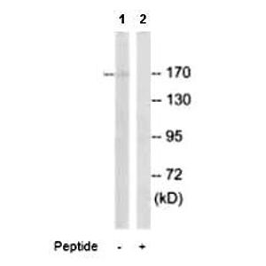 Anti-TMEM192 antibody [EPR14330-67] - BSA and Azide free(AB232600)