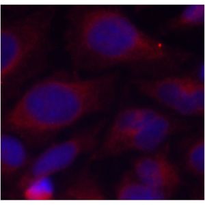 Picro Sirius Red Stain Kit (Connective Tissue Stain)(AB150681)