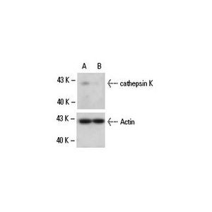 cathepsin K siRNA (m)