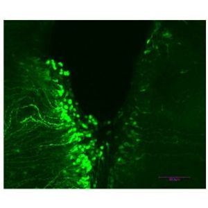 In vivo ViroMag -In vivo Transfection Reagent