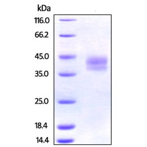 Anti-CD11c antibody [EP1347Y] - BSA and Azide free(AB216655)