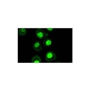 cyclin D1 (72-13G) Alexa Fluor® 647