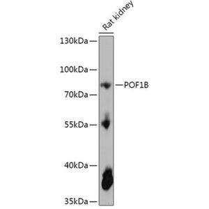 Anti-POF1B antibody