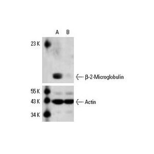 β-2-Microglobulin siRNA (h)