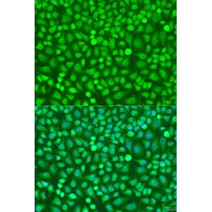 Anti-HOXB5 antibody
