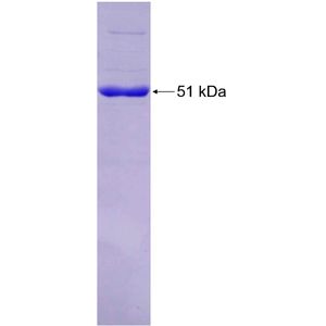 Recombinant Human ALKBH7 protein, GST-tagged