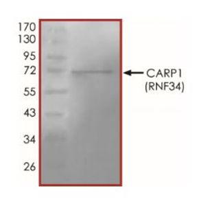Anti-Dystrophin antibody(AB15277)