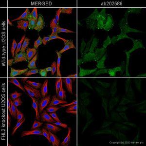 Anti-SDHB antibody [21A11AE7](AB14714)