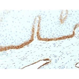 Human Anti-Candida albicans IgG ELISA Kit(AB108715)