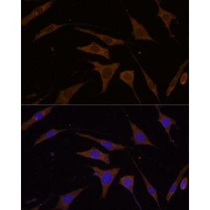 Anti-RPL7 antibody