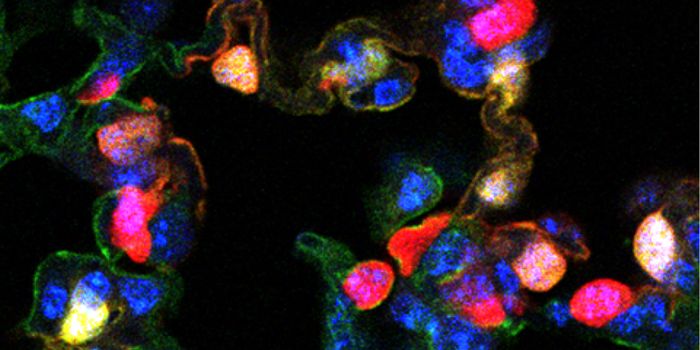 Finding Points to a Cause of Chronic Lung Disease