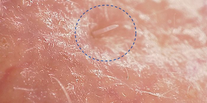 How Mites That Live on Our Faces are Evolving to Become Symbionts