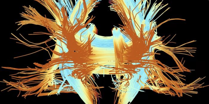 Protein Linked to Fragile X and Autism is a Treatment Target