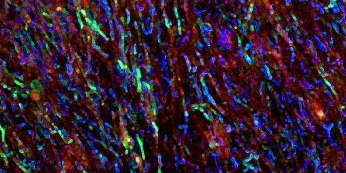 Brain and Gut Link in Multiple Sclerosis